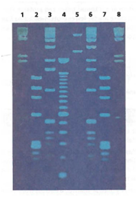 Interpreting Graphics The photograph below shows eight lanes (columns) in a gel. These lanes contain DNA fingerprints of samples taken from a crime. How many individuals are represented by this collection of eight samples?   