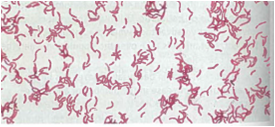 Analyzing Graphics Examine the photograph below, which shows bacteria that have been treated with a Gram stain. Would you hypothesize that these bacteria produce endotoxins? Explain your answer.   