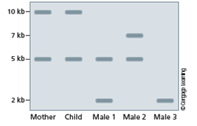 A PCR-based paternity test is conducted using STRs that consistently produce a unique DNA fragment pattern from a single chromosome. Examining the results of the following Southern blot, which male(s) can be excluded as the father of the child? Which male(s) could be the father of the child?
