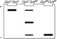 Glutamate oxaloacetic transaminase-2 (GOT-2) is a mitochondrial enzyme that synthesizes glutamate from aspartate and ketoglutarate. GOT-2 is a homodimer-a protein made of paired identical polypeptides. The Got-2 M mutation introduces a single amino-acid change that alters the charge of the polypeptide produced by the normal Got-2 + allele. When enzymes from Got-2 + Got-2 + homozygotes, Got-2 + Got-2 M heterozygotes, and Got-2 M Got-2 M homozygotes are separated by charge using gel electrophoresis, the gel shows the following pattern of bands (thicker bands indicate more protein): a. Compared to the normal GOT-2 polypeptide, is the polypeptide produced in Got-2 M Got-2 M mutants more basic or more acidic? b. Explain the pattern and relative intensities of the bands seen in each Got-2 genotype. c. Figure shows the pattern of bands seen when hemoglobin of individuals with sickle-cell trait is separated by charge using gel electrophoresis. Why do heterozygotes have only two types of hemoglobin, while Got-2 M Got-2 M heterozygotes have three types of GOT-2 protein?