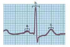 Choose the best answer for each question. Label the following ECG wave chart.  