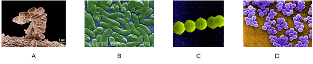 Which of the following slides is a good example of staphylococci?  <div style=padding-top: 35px> 
