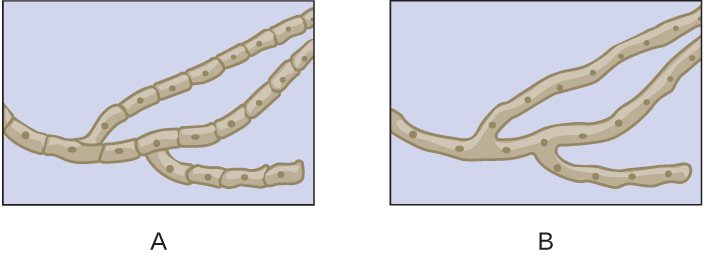 Which of the drawings shows septate hyphae?  <div style=padding-top: 35px> 