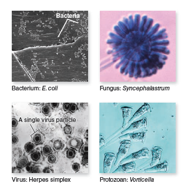 From chapter 1, figure 1.6. Which of these photos from chapter 1 is an SEM image Which is a TEM image  Figure 1.6 Five types of microorganisms. The drawing at top right shows relative size differences. The photos of organisms around the drawing are pictured at different magnifications in order to show their details.   