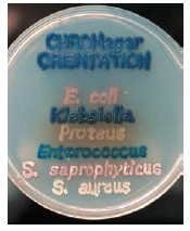 From chapter 3, figure 3.6 b. Do you believe that the bacteriaspelling Klebsiella or the bacteria spelling S. aureus possessthe larger capsule Defend your answer. Figure 3.6 b: Media that differentiate characteristics. (b) A state-of-the-art medium developed for culturing and identifying the most common urinary pathogens. CHROMagar Orientation uses color-forming reactions to distinguish at least seven species and permits rapid identification and treatment. In the example, the bacteria were streaked so as to spell their own names.