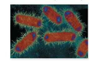 From chapter 4, figure 4.11 a. Speculate on why these cells contain two chromosomes (shown in blue). figure 4.11 a Form and function of bacterial fimbriae.     (a) Several cells of pathogenic Escherichia coli covered with numerous stiff fibers called fimbriae (30,000×). Note also the dark-blue granules, which are the chromosomes.