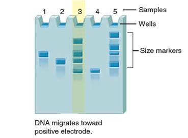 Critical thinking is the ability to reason and solve problems using facts and concepts. These questions can be approached from a number of angles and, in most cases, they do not have a single correct answer. Based on the following image:     a. Explain where the charges should be applied to this gel in order for the DNA samples to migrate properly. b. Identify the largest DNA fragment in sample 5. Explain your selection.