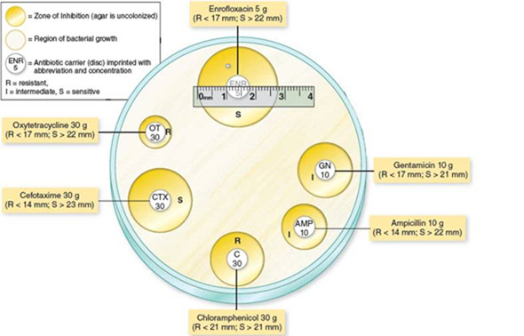 Referring to figure 12.1 a , determine whether the cultured bacterium is sensitive, intermediate, or resistant to each of the antibiotic drugs tested and provide an explanation in each case. b. Referring to figure 12.3 a , determine the minimum inhibitory concentration (MIC) of the drugs being tested, providing an explanation for your answer. Figure 12.1a Technique for preparation and interpretation of disc diffusion tests. (a) Standardized methods are used to seed a lawn of bacteria over the medium. A dispenser delivers several drug-impregnated discs onto a plate, followed by incubation. Interpretation of results: During incubation, antimicrobials become increasingly diluted as they diffuse out of the discs into the medium. If the test bacterium is sensitive to a drug, a zone of inhibition develops around its disc. Roughly speaking, the larger the size of this zone, the greater is the bacterium's sensitivity to the drug. The diameter of each zone is measured in millimeters and evaluated for susceptibility or resistance by means of a comparative standard (see table 12.3).     (a) *R and S values differ from table 12.3 due to differing concentrations of the antimicrobials. Table 12.3 Results of a Sample Kirby-Bauer Test      Figure 12.3a: Tube dilution test for determining the minimum inhibitory concentration (MIC). (a) The antibiotic is diluted serially through tubes of liquid nutrient from right to left. All tubes are inoculated with an identical amount of a test bacterium and then incubated. The first tube on the left is a control that lacks the drug and shows maximum growth. The first tube in the series that shows no growth (no turbidity) contains the concentration of antibiotic that is the MIC.   
