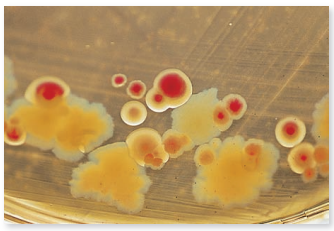 From chapter 3, figure 3.5 b. What biochemical characteristic does this figure illustrate How could this characteristic be used to begin the identification of these organisms Explain your answer. Figure 3.5 Examples of media that are both selective and differential. (b) MacConkey agar selects against gram-positive bacteria. It also differentiates between lactose-fermenting bacteria (indicated by a pink-red reaction in the center of the colony) and lactose-negative bacteria (indicated by an off-white colony with no dye reaction).