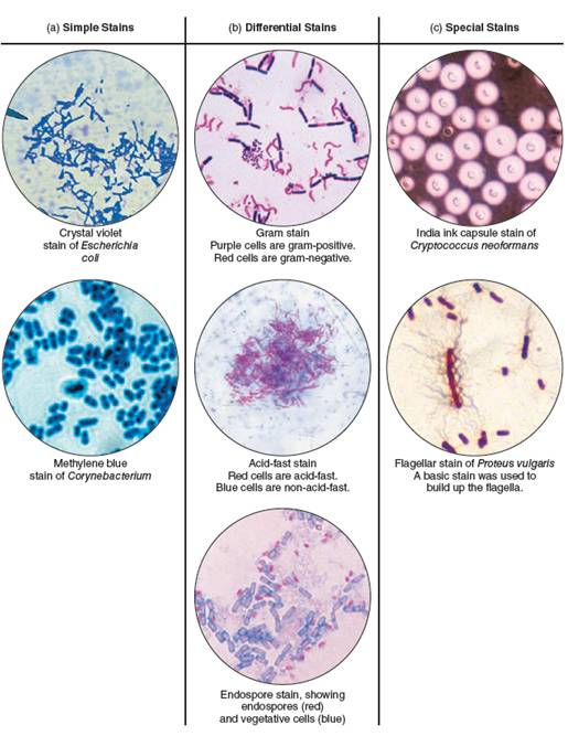 From chapter 3, figure 3.21. Without looking back to the figure in chapter 3, speculate on which meningitis-causing organism you are seeing here. How could your presumptive diagnosis be confirmed  Figure 3.21 Types of microbiological stains. (a) Simple stains. (b) Differential stains: Gram, acid-fast, and spore. (c) Special stains: capsule and flagellar.   