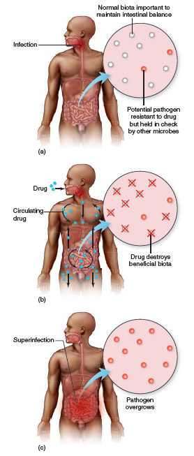 From chapter 12, figure 12.15. Assume that the growth on the first plate represents normal intestinal microbiota. How could you use these illustrations to explain the development of C. difficile -associated colitis Figure 12.15: The role of antimicrobials in disrupting microbial biota and causing superinfections. (a) A primary infection in the throat is treated with an oral antibiotic. (b) The drug is carried to the intestine and is absorbed into the circulation. (c) The primary infection is cured, but drug-resistant pathogens have survived and create an intestinal superinfection.