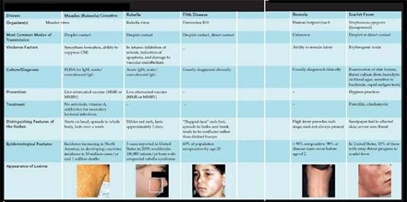 From chapters 20 and 23, figures 20.16 and 23.13 a. Compare these two rashes. What kind of information wouldhelp you determine the diagnosis in both cases b. Now compare both of these to the rashes summarized in Disease Table 18.7 (p. 532-533). Which of the diseases in Disease Table 18.7 most resembles the rashes in the preceding question, and how would you distinguish among it, the rash from figure 20.16, and the one from figure 23.13 a Figure 20.16: The rash in RMSF. This case occurred in a child several days after the onset of fever. Also pictured is an example of the hard ticks that transmit the infection.   Figure 23.13 a : Symptom of secondary syphilis. The skin rash in secondary syphilis can form on the trunk, arms, and even palms and soles (these latter locations are particularly diagnostic). The rash does not hurt or itch and can persist for months.   Disease Table 18.7: Maculopapular Rash Diseases  <div style=padding-top: 35px> 