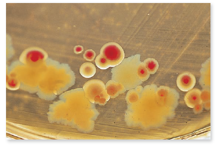 From chapter 3, figure 3.5 b. If this MacConkey agar plate was inoculated with well water, would you report that coliforms were present in the water  Figure 3.5 b: Examples of media that are both selective and differential. (b) MacConkey agar selects against gram-positive bacteria. It also differentiates between lactose-fermenting bacteria (indicated by a pink-red reaction in the center of the colony) and lactose-negative bacteria (indicated by an off-white colony with no dye reaction).   