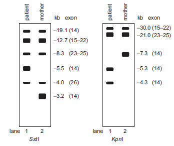 A deficiency in factor VIII causes hemophilia A, a blood disorder. Researchers studying hemophilia A evaluated the DNA from an affected patient and the patient's unaffected mother. They analyzed the 186-kb-long factor VIII gene that includes 26 exons (see Chapter 14). After digesting the genomic DNA with KpnI or SstI and separating the products by gel electrophoresis, the researchers probed the DNA with a radiolabeled cDNA probe that binds the factor VIII gene in a region that includes exons 14-26. The size of the fragments and the corresponding exon(s) are shown on the right of autoradiograms. The researchers conclude a transposon inserted into one of the exons of the factor VIII. A. Describe the differences between the patient and mother S st I digest results. Be specific. B. Describe the differences between the patient and mother KpnI digest. Be specific. C. Propose an hypothesis explaining the observed differences including what exon of the factor VIII gene contains the transposon. Data adapted from Kazazian Jr. et al. (1988. Nature 332 :164-166).