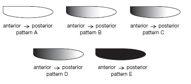 Bicoid mRNA is maternally derived and localized to the anterior of early Drosophila embryos. Bicoid protein is a concentration-dependent transcriptional activator of the hunchback gene. Depicted below are embryos in which a reporter is expressed under the control of the wild-type hunchback promoter. The darkened regions indicate reporter expression. Use these patterns to answer the following questions.     A. Which expression pattern would you expect in embryos from a mother that does not express bicoid mRNA? Explain. B. Drosophila flies are diploid organisms. This results in a pattern of reporter expression that most closely resembles pattern C. Would you expect this pattern to change if the mother had only one copy of the bicoid gene? If no, explain why not. If yes, explain and select the most likely expression pattern from the choices above. C. The hunchback promoter contains high-affinity and low-affinity binding sites for Bicoid protein. Which expression pattern would you expect if the hunchback promoter was mutated so that it now contains only the low-affinity binding sites for Bicoid protein and the mother has two copies of the bicoid gene? Explain your choice.