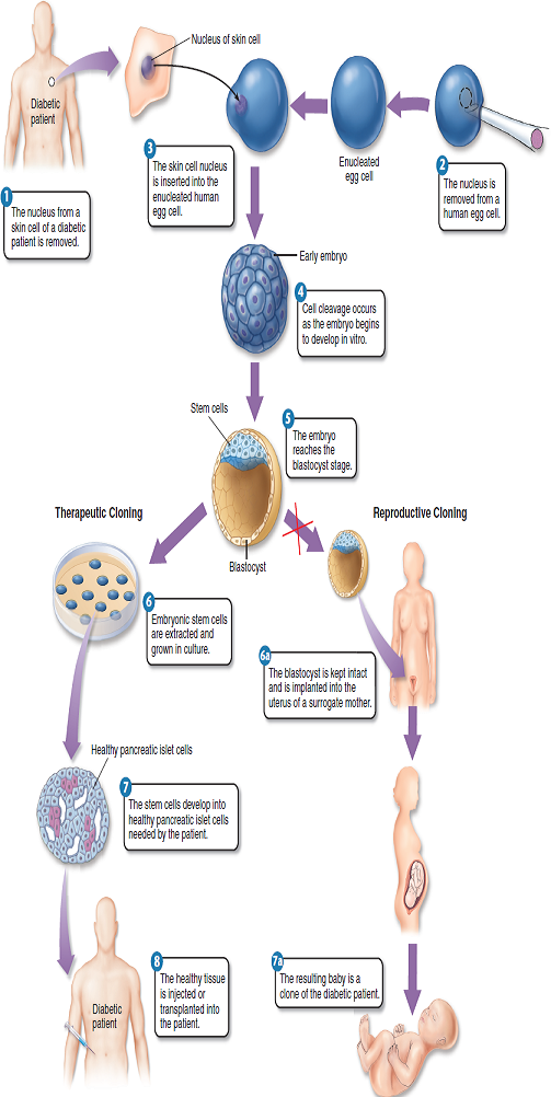 The goal behind therapeutic cloning is to replace tissue that is damaged due to an accident or nongenetic disease. Why wouldn't therapeutic cloning as shown in figure 16.8 work to replace tissue damage caused by genetic disorders  Figure 16.8      Figure 16.8 How human embryos might be used for therapeutic cloning.  Therapeutic cloning differs from reproductive cloning in that after the initial similar stages, embryonic stem cells from the early embryo are extracted, grown in culture, and added to a tissue of the individual who provided the nucleus. By contrast, in reproductive cloning (forbidden in humans), the embryo is preserved to be implanted and grown to term in a surrogate mother. It is this latter procedure that was done in cloning Dolly the sheep.