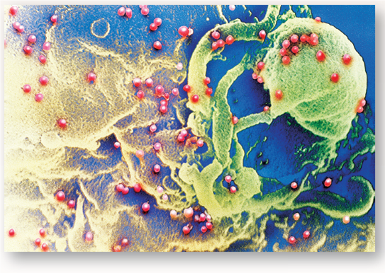 Does HIV Infect All White Blood Cells?  Humans are protected from microbial infections by their immune system, a collection of cells that circulate in the blood. Loosely called white blood cells, this collection actually contains a variety of different cell types. Some of them possess CD4 cell surface identification markers (think of them as id tags). Cells that trigger antibody production when they detect virus-infected cells and macrophage cells that initially attack invading bacteria both carry CD4 Id tags. Other cells possess CD8 Id tags, such as killer cells, which are immune cells that bore holes into virus-infected cells. In an aids patient, neither CD4 nor CD8 cells actively defend against HIV infection. Are either or both of these cell types killed by the HIV virus? To investigate this issue, researchers mixed together cd4-tagged cells (called cd4+ cells) and CD8-tagged cells (called CD8+ cells), and then added HIV to the mixture. HIV, colored red in the electron micrograph shown here, was then able to infect either kind of cell. The white blood cell culture was monitored at 5-day intervals for 25 days, taking a sample at each interval and scoring it for how many CD4 + cells and how many CD8 + cells it contained. The surviving percentage of each cell type in each sample is presented in the graph on the right above.      Further Analysis neither CD4 + nor CD8 + cells actively defend AIDS patients. If one of them is not eliminated by HIV, why do you suppose it ceases to defend HIV-infected aids patients? Can you think of a way to investigate this possibility?