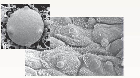 Are Chytrids Killing the Frogs ? As you learned in section 18.6 of this chapter, chytrid fungi are thought to be playing a major role in a worldwide wave of amphibian extinctions, discussed in much more detail in chapter 38 (page 809). Our awareness of the possible role of chytrids began in Queensland (the northeastern portion of australia) in 1993, when a mass die-off of frogs was reported. All different kinds of frogs seemed to be affected, and entire populations were wiped out. In the rainforests of northern Queensland, populations of the sharp-nosed torrent frog ( Taudactylus acutirostris ) were found to be so seriously affected as to be in danger of extinction. Captive colonies were set up at James Cook University and at the Melbourne and taronga zoos in an attempt to preserve the species. Unfortunately, the preservation of the species failed. Every frog in the colonies died. What was killing the frogs? The answer to this question came in 1998, when researchers examined the epithelium (skin) of sick frogs under the scanning electron microscope and saw what you can see in the photomicrographs to the right. Normally a relatively smooth surface, the epithelium of the dying frogs was roughened, with spherical bodies protruding from the surface. These protrusions are zoosporangia, asexual reproductive structures of a chytrid fungus. One is shown up close ( inset ). Each zoosporangium is roughly spherical, with one or more small projecting tubes. Millions of tiny zoospores develop in each zoosporangium. When the plug blocking the tip of a tube disappears, the spores are discharged onto the surface of adjacent skin cells or into the water, where their flagella allow them to swim until they encounter another host. When one of the zoospores contacts the skin of another frog, it attaches and forms a new zoosporangium in the subsurface layer of the skin, renewing the infection cycle. Study of the infecting chytrids revealed them to be members of the species Batrachochytrium dendrobatidis. This was unexpected. Chytrids are typically found in water and moist soil, and although there are several types known to infect plants and insects, no chytrid had ever been known to infect a vertebrate. These initial scanning electron micrograph results seemed to make a pretty convincing case that chytrids had caused the mass die-off of frogs in Queensland. However, in order to provide more direct evidence, a series of experiments was carried out in which the ability of the chytrid fungus to kill frogs was directly assessed. In one such experiment, typical of many, some frogs of the genus Dendrobates were exposed to chytrids and others were not. After three weeks, all frogs were examined for shed skin, a clinical sign of the frog-killing disease. The results are seen in the pie charts above.      Making Inferences Is there any association between exposure to the chytrid B. dendrobatidis and development of the skin infection that is a clinical sign of life-threatening illness in frogs?