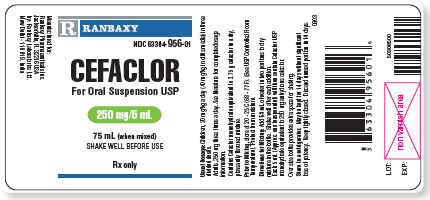 Read the dosage labels and literature provided to answer the questions. Is an order for 250 mg of cefaclor every 8 hours correct for this child? _______