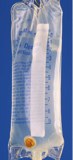 The IV in Figure of 1000 mL has an ordered rate of 80 mL/hr. It was started at 5:40 am. Infusion time _______ Completion time _______ Figure    