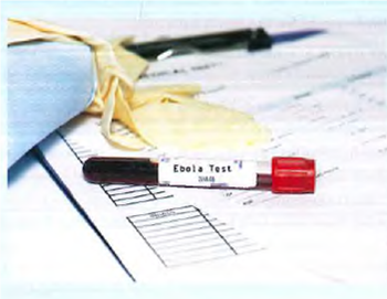 EMERGING MARKETS: The Ebola Challenge First reported in 1976 in Sudan and Zaire (now called the Democratic Republic of the Congo [DRC]), Ebola has been a known virus for four decades. Yet, there is still no effective vaccine or medicine. Between 1976 and 2013, there were 24 outbreaks in Sub-Saharan Africa, with 1,716 cases. What really put Ebola on the center stage of global media- and on the pages of this book- was the 2014 outbreak, which was the most devastating outbreak with 15,000 reported cases and 6,000 deaths. Starting in Guinea, Liberia, and Sierra Leone, the disease quickly diffused to other West African countries, such as the DRC, Nigeria, and Senegal. By September 2014, a Liberian man who traveled to Dallas,Texas, was diagnosed to have Ebola. He died in early October. Two American nurses who treated the patient became the first confirmed cases to be infected by Ebola in the United States, triggering panic and chaos not only inTexas but also in other parts of the country. State governments in Connecticut, Illinois, New Jersey, and New York demanded that anyone who traveled from affected West African countries be subject to 21 days of quarantine- the longest period the Ebola virus was thought to need to incubate. In mid October 2014, President Obama appointed a national Ebola response coordinator. All passengers arriving from affected African countries now had to go through screening, and all patients showing up at a US health care establishment had to answer a questionnaire regarding whether they traveled from these countries. In the absence of effective vaccine or medicine, treatment was indirect. It centered on early supportive care with rehydration and symptomatic treatment. The measures would include management of pain, nausea, fever, and anxiety, as well as rehydration via the oral or by intravenous (IV) route. Blood products such as packed red blood cells, platelets or fresh frozen plasma might also be used. Intensive care was often used in the developed world. This might include maintaining blood volume and electrolytes (salts) balance as well as treating any bacterial infections. Thankfully, the two American nurses recovered after several weeks of treatment, as did the other six American health care workers who went to Africa and came home with Ebola By December 2014, there had been ten Ebola cases in the United States, and only two resulted in death- the second case of death was an African doctor who was contaminated by his patients in an Ebola-infested country. Throughout the crisis, the initial silence of the pharmaceutical industry was conspicuous. Dr. Margaret Chan, Director-General of the World Health Organization (WHO), criticized the industry for failing to develop a vaccine for Ebola over the four decades during which the virus threatened poor African countries. She complained that a profit-driven industry does not invest in products for markets that cannot pay. Initially reluctant, some pharmaceutical firms jumped in. In October 2014, British drugmaker GlaxoSmithKline (GSK) announced that it had expedited its R D in search of a vaccine. In 2010, the Canadian government developed an experimental vaccine VSV-EBOV and licensed it to a small, virtually unknown biotech firm NewLink Genetics in Ames, Iowa, for clinical trials. However, progress was slow and funding tight. In November 2014, a US giant, Merck, paid NewLink US$50 million to buy the rights to the vaccine and to expedite R D. Also in November 2014, a French Big Pharma player, Sanofi, announced its intention to work with industry partners to combat Ebola. Another experimental drug ZMapp, developed by a small San Diego, California-based biopharmaceutical firm, Mapp, showed encouraging results on primates, and had been used on at least seven (human) patients in Africa in 2014. But ZMapp had not received FDA approval. In the absence of the financial, technological, and production capabilities of Big Pharma, ZMapp's stocks quickly ran out. The US government had to provide US$25 million to scale up production. The reason that until recently, pharmaceutical firms- especially Big Pharma firms- had been reluctant to apply their significant resources to find a cure for Ebola was simple. Even if successful, these efforts, which would mostly benefit African countries, would not be profitable. In other words, there was no compelling business case. Now that the disease came to the United States (and a few Western European countries), firms felt compelled to move. Debates continued to rage. One side argued that pharmaceutical firms only focused on markets and products from which they could profit- with Botox, baldness, and bonus as their guiding light. Tropical diseases such as malaria and Ebola naturally would receive little (or no) attention. Another side argued that given limited resources, pharmaceutical firms rightly and strategically ignored (relatively) smaller-scale diseases such as Ebola, because there were other diseases such as HIV/AIDS that impact a lot more people than Ebola. A number of pharmaceutical firms jumped onto the Ebola bandwagon simply to earn CSR kudos, knowing that they would be unlikely to make any profits for their efforts. Or they were simply driven to do so due to public pressure- the series of eager announcements made in October and November 2014 were defensive in nature. Given the long lead time to develop any effective vaccine and the urgency to have a vaccine at hand when confronting an outbreak of Ebola (and other contagious diseases), how pharmaceutical firms manage their quest for the triple bottom line remains one of the leading strategic challenges they have to overcome. Sources: Based on (1) C. Campos, C. Cole, J. Steele, 2014, Ebola and corporate social responsibility, EMBA strategy class term project, November, Jindal School of Management, University of Texas at Dallas; (2) CBC, 2014, Canada should cancel NewLink Ebola vaccine contract, November 19: www.cbc.ca; (3) Independent, 2014, Ebola outbreak: Why has 'Big Pharma' failed deadly virus's victims September 7: www.independent.co.uk; (4) National Public Radio, 2014, Merck partners w ith NewLink to speed up work on Ebola vaccine, November 24: www.npr.org; (5) Time, 2014, WFIO pillories drug industry for failure to develop Ebola vaccine, November 4: time.com; (5) World Health Organization, 2014, Ebola virus disease fact sheet, November: www.who.int.     As a shareholder of a pharmaceutical firm that announced its new investment to develop an Ebola vaccine and that as a result, your dividend would be reduced, would you support or not support the firm's decision to spend your money to combat Ebola