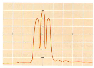 The spectrum analyzer display in Figure 3.21 represents the output of an AM transmitter. The analyzer has an input impedance of 50 and is connected to the transmitter output through a 60 dB attenuator. Sketch the envelope of the signal in the time domain, as it would appear at the transmitter output terminals. Be sure to show both time and voltage scales. Figure 3.21      Reference level: -10 dBm Vertical: 10 dB/division Center frequency: 21.200 MHz Span: 5 kHz/division