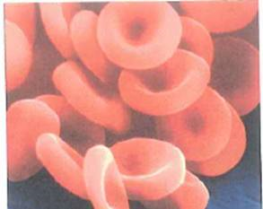 Fig. is a picture of red blood cells seen under a scanning electron microscope. Normally, women possess about 4.5 million of these cells in each cubic millimeter of blood. If the blood flow to the heart is 250 mL/min, how many red blood cells does a woman's heart receive each second      FIGURE Red blood cells See Exercise.