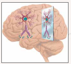 Mirrors in Your Brain?  When we see someone yawn, we yawn too. When we watch a spider crawl up someone's leg, we get creepy sensations on our leg. When we see someone in danger, we experience a wave of fear. When we see someone's arm get jabbed with a sharp needle, the muscles in our arms tense up and our breathing intensifies. When we watch our favorite Olympic athlete near the finish line to win first place, our heart races with excitement. How can simply observing others lead us to experience such intense responses so similar to those experienced by the people we are observing? The answer is found in our brain cells. A type of neuron, called a mirror neuron, helps explain how we effortlessly read other people's minds and empathize with them?feel what they do. Mirror neurons automatically put us in somebody else's shoes. Not convinced? Consider brain scan research that finds that romantic partners who observe loved ones in pain show similar activity in their emotional brain areas as that experienced by the loved ones. It turns out that when we empathize with someone's pain, on some level we actually feel pain! One fascinating characteristic of mirror neurons is that they are the only brain cells that are activated the same way whether we are seeing or doing. These special neurons mirror what the other person is doing. For instance, when we see someone smiling, our mirror neurons for smiling get activated, which triggers neural activity leading to feelings associated with smiling, such as happiness. In other words, we get all the benefits of smiling without making even the slightest movement of our lips! Mirror neurons also help us understand someone's intentions. They get activated when we watch someone do something, which helps us predict what their goal is and what they may do next. For example, if you see a boy begin to reach for candy on the counter in front of him, you have a copy of what he is doing in your brain, which helps you to understand his goal (getting the candy). Research on mirror neurons is still in its infancy, and much has yet to be learned. But, for now, those of us who are embarrassed by our free-flowing tears during dramatic scenes in television programs, movies, and, yes, sometimes even commercials should be relieved to know that the emotions we experience may be out of our control; that is, we may not be able to contain our tears after all.    Question How might mirror neurons be involved in the enjoyment of watching pornography?