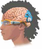 There are two basic causes of deafness. If the cause is wax in the auditory canal, injury to the tympanic membrane, or malfunction of the ossicles, it is called (a) _____deafness. If the cause is damage to hair cells in the cochlea or to the auditory nerve, it is called (b) _____deafness. One treatment for neural deafness is to use a (c) _____, which is more effective if individuals have learned to speak before becoming deaf.  