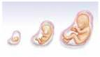 The prenatal period, which begins at conception and ends at birth, is composed of three different stages. The first stage of prenatal development refers to the two-week period following conception; this is called the (a) _____ stage. The second stage of the prenatal period spans the 2-8 weeks that follow conception; this is called the (b) _____ stage. The third stage of the prenatal period begins two months after conception and lasts until birth; this is called the (c) _____ stage.  