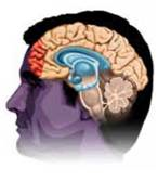 Piaget's fourth cognitive stage, which begins in adolescence and continues into adulthood, is called the (a) _____ stage. During this stage, adolescents and adults develop the ability to think about (b) _____ concepts, plan for the future, and solve abstract problems. One reason adolescents engage in more risky behaviors is that they have an underdeveloped (c) _____ but a fully functioning emotional center, called the (d) _____