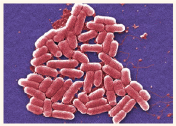 The electron micrograph to the right shows a group of bacterial cells. The micrograph has been magnified 5,000X. Calculate the actual length of the bacterial cells in micrometers ( m)  Courtesy of Janice Hanley Carr/CDC.   