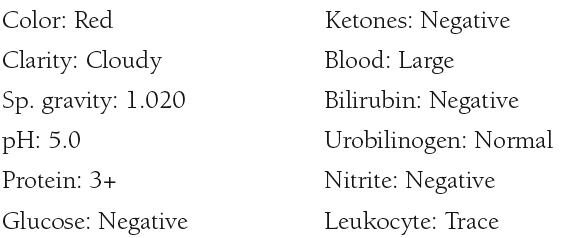 A 14-year-old boy who has recently recovered from a sore throat develops edema and hematuria. Significant laboratory results include a BUN of 30 mg/dL (normal 8 to 23 mg/dL) and a positive group A streptococcal antibody test. Results of a urinalysis are as follows:   <i>Microscopic:</i> 100 RBCs/hpf—many dysmorphic forms 5–8 WBCs/hpf 0–2 granular casts/lpf 0–1 RBC casts/lpf a. What disorder do these results and history indicate? b. What specific characteristic was present in the organism causing the sore throat? c. What is the significance of the dysmorphic RBCs? d. Are the WBCs significant? Why or why not? e. What is the expected prognosis of this patient? f. If the above urinalysis results were seen in a 5-year-old boy who has developed a red, patchy rash following recovery from a respiratory infection, what disorder would you suspect? 