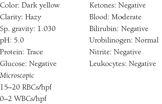  A 40-year-old man develops severe back and abdominal pain after dinner. The pain subsides during the night but recurs in the morning, and he visits his family physician. Results of a complete blood count and an amylase are normal. Results of a routine urinalysis are as follows:   Few squamous epithelial cells a. What condition could these urinalysis results and the patient’s symptoms represent? b. What would account for the crenated RBCs? c. Is there a correlation between the urine color and specific gravity and the patient’s symptoms? d. Based on the primary substance that causes this condition, what type of crystals might have been present? e. What changes will the patient be advised to make in his lifestyle to prevent future occurrences? 