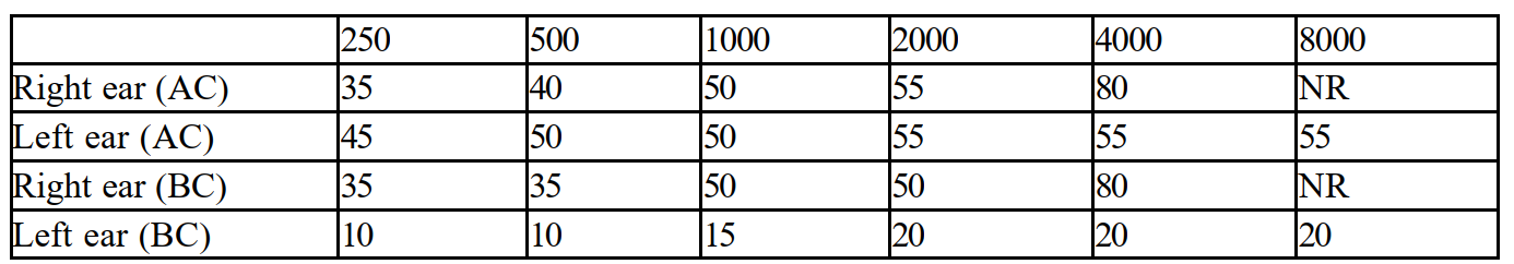 Plot an audiogram based on the following information and describe the hearing loss.   