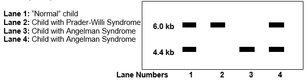 The figure below shows the results of methylation analysis of DNA from a normal child, a child with Prader-Willi Syndrome, and two children with Angelman Syndrome. Southern blot of genomic DNA digested with HindIII and HpaII, probed with PW71B, a chromosome 15-specific probe. ‪   Interpret the results for each lane.<div style=padding-top: 35px> 