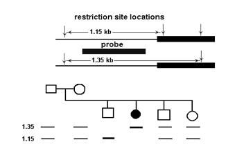 Pedigree analysis was used to determine whether a genetic marker is inherited with a disease trait (black circle) . Results of Southern blot analysis of restriction endonuclease-digested DNA from members of the family are shown. What conclusions can be drawn from the data?   A)  A restriction fragment length polymorphism (RFLP)  is linked to this autosomal recessivetrait. B)  A restriction fragment length polymorphism (RFLP)  is linked to this autosomal dominanttrait. C)  The disease is caused by expansion of a trinucleotide repeat. D)  No information can be gained from this analysis because researchers should haveperformed a Northern blot, not a Southern blot.