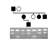 Pedigree analysis was used to determine whether a genetic marker is inherited with a disease trait (black symbols) . Results of Southern blot analysis of restriction endonuclease-digested DNA from members of the family are shown. What conclusions can be drawn from the data?   A)  A restriction fragment length polymorphism (RFLP)  is linked to this autosomal recessivetrait. B)  A restriction fragment length polymorphism (RFLP)  is linked to this autosomal dominanttrait. C)  The disease is caused by expansion of a trinucleotide repeat. D)  No information can be gained from this analysis because researchers should haveperformed a Northern blot, not a Southern blot.