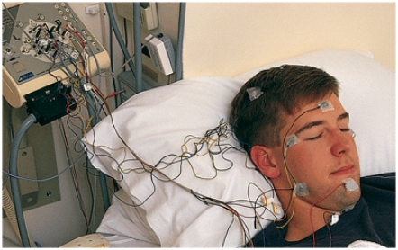 In a sleep lab, electrodes hooked up to the patient will probably measure _______, which is (are)  common for researchers to measure.   A)  heart rate, respiration, and blood pressure B)  brain waves, muscle activity, and eye movements C)  heart rate, muscle movements, and sexual arousal D)  brain waves, myocardial functioning, and ocular movements