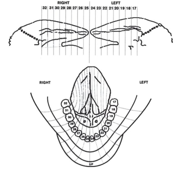 Color in the field of anesthesia and list the structures anesthetized by a lingual nerve block.   