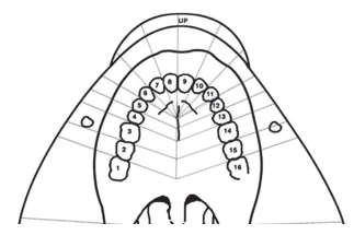 Color in the field of anesthesia and list the structures anesthetized by a P-ASA nerve block.  <div style=padding-top: 35px> 