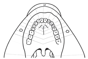 Color in the field of anesthesia and list the structures anesthetized by an IO nerve block.   