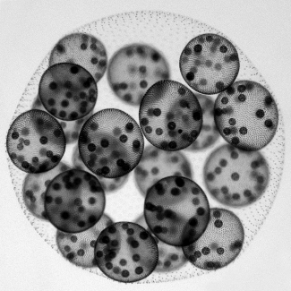 <strong>Volvox, the multicellular green alga shown below, has flagellated cells on its surface cells but not on interior cells. How might this condition develop? </strong> A)Interior cells attempt to grow flagella, but the lack of open space suppresses the effort. B)Interior cells discard the genetic instructions for flagella once their interior position is established. C)The commitment of resources for photosynthesis reduces the availability of protein and other biomolecules needed to produce flagella. D)Signals from surface cells or the absence of signals from the environment to the plasma membranes of the interior cells suppresses the growth of flagella.