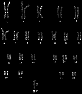 In what way(s) would the karyotype shown below be different if the material used to prepare the analysis were an egg or sperm cell?   A) The total number of chromosomes would be 23 in this example. B) No homologous pairing would be possible. C) The sex chromosome would be represented by a single X or a single Y rather than a pair. D) all of the above