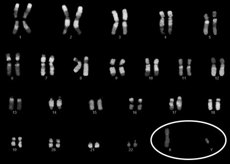 Except for the circled pair, all the chromosomes in this figure are called ____________________.   
