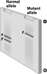<strong>The genes for the normal mutant alleles of a gene are cut with the same restriction enzyme. The resulting DNA fragments were separated by gel electrophoresis, producing the gel shown in the figure below. Why are the patterns produced by these two alleles different? </strong> A)The normal hemoglobin gene is cut by two restriction enzymes, but the sickle cell anemia allele is cut by only one restriction enzyme. B)The gene for the normal allele is much larger than the gene for sickle cell anemia. C)The gene for the normal allele has a sequence recognized by DdeI, but the gene for sickle cell anemia does not. D)The sickle cell allele has the ability to produce ligase to repair the damage done by restriction enzymes, but the normal allele does not.
