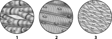 Analyze the tissue images below and select which statement is true.   A) Tissue 1 can be found lining the digestive tract. B) Tissue 1 is used to line the endocrine system. C) Tissue 2 is found attached to bones. D) Tissue 3 is used to conduct nerve impulses