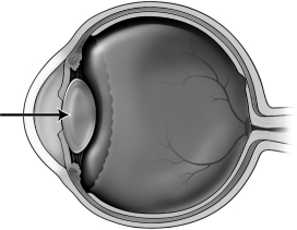 The figure below depicts a human eye.   When focusing on an object that is far away, the structure indicated by the arrow in the figure above A) becomes flatter. B) becomes more spherical. C) does not change. D) decreases in diameter.