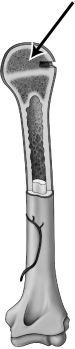 The illustration below   A) reveals that bone contains both hard and soft components. B) suggests that bones are extremely rigid. C) shows that bones are heavy and densely packed. D) highlights how bones are very fragile.