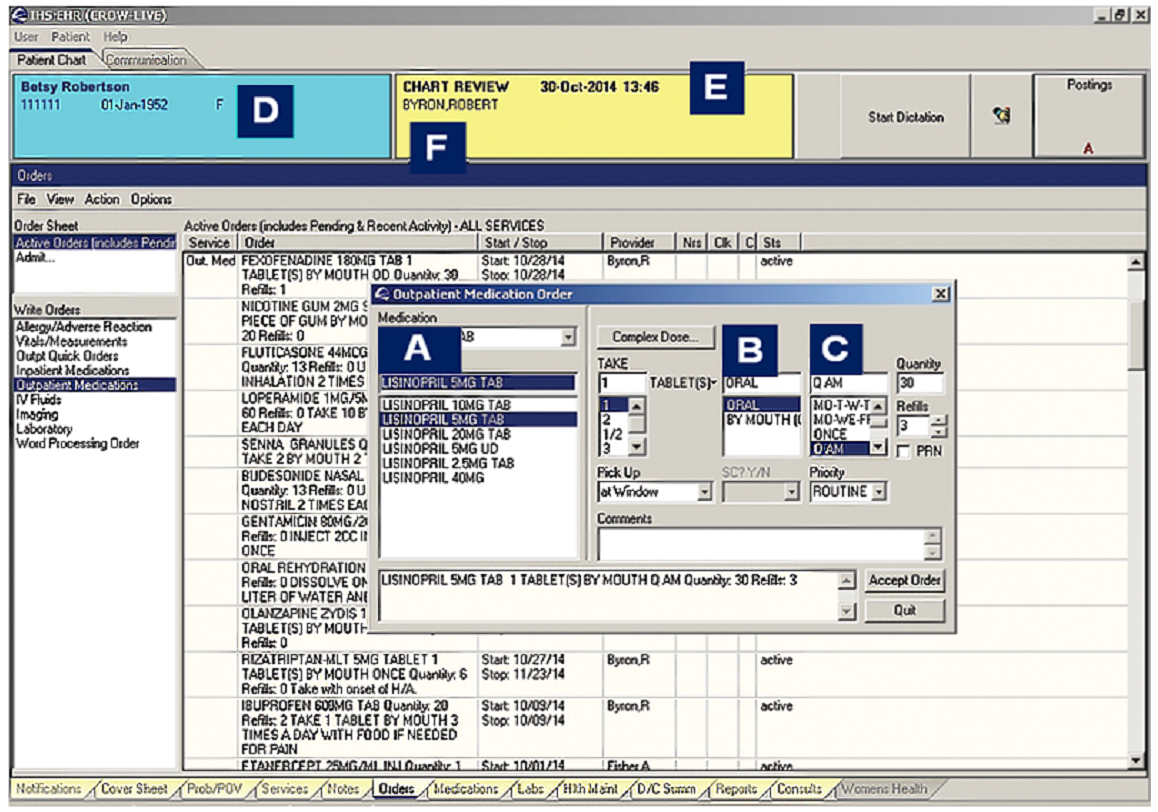 For this electronic order, frequency is represented by the letter   A)  A. B)  B. C)  C. D)  E.